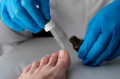 Анализ на определение днк грибов дерматофитов (dermatophytes) в соскобах с кожи и ногтевых пластинок методом пцр