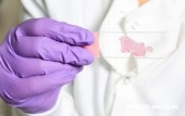 Цитологическое исследование отделяемого молочной железы