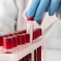 Биохимические исследования крови