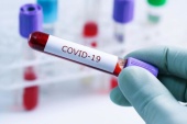 Программа "Диагностический скрининг после COVID-19 (оптимальный)"