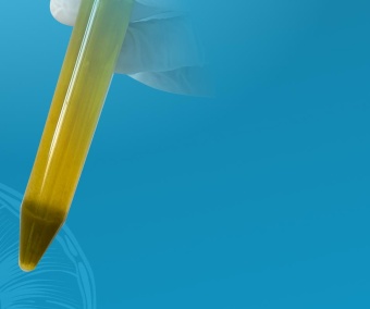 Микроскопическое исследование дуоденального содержимого