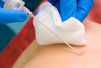 Пункция патологического образования