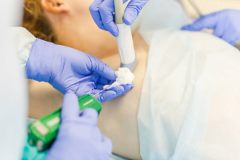 Иссечение патологического образования с последующим гистологическим исследованием